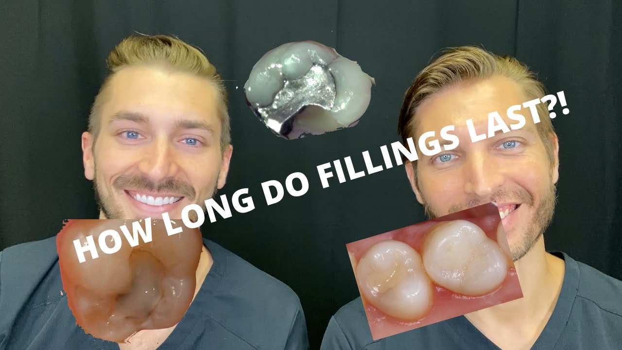 How Long Do Fillings Take